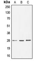 BRMS1 Antibody (Internal)