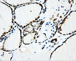 SORD / Sorbitol Dehydrogenase Antibody (clone OTI15H2)