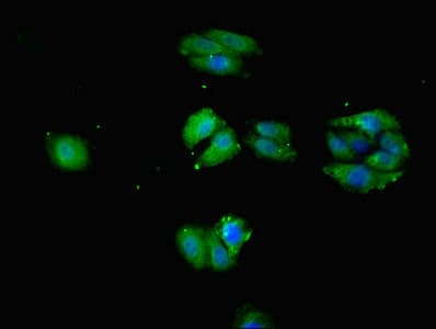 SLC1A7 / EAAT5 Antibody