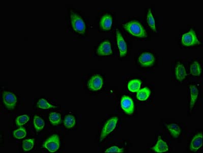 Polyclonal Rabbit anti-Human ZDHHC1 Antibody (IHC, IF, WB)