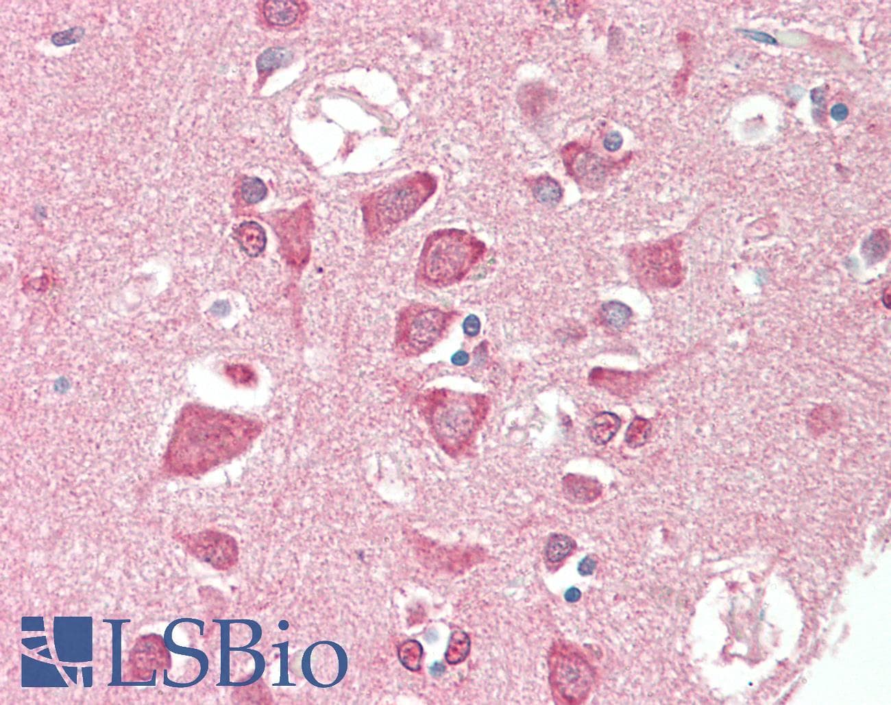 IHC-plus™ TSG / TWSG1 Antibody (clone 2F3)