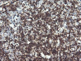 CD45 / LCA Antibody (clone OTI2F1)