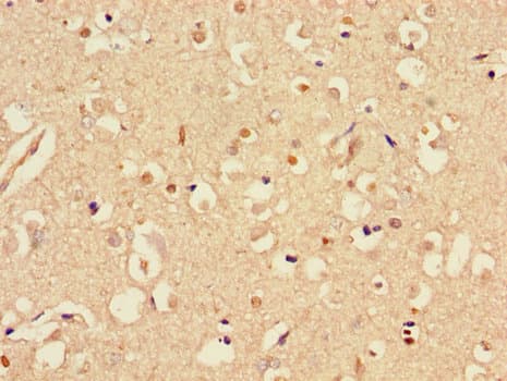 STMN1 / Stathmin / LAG Antibody