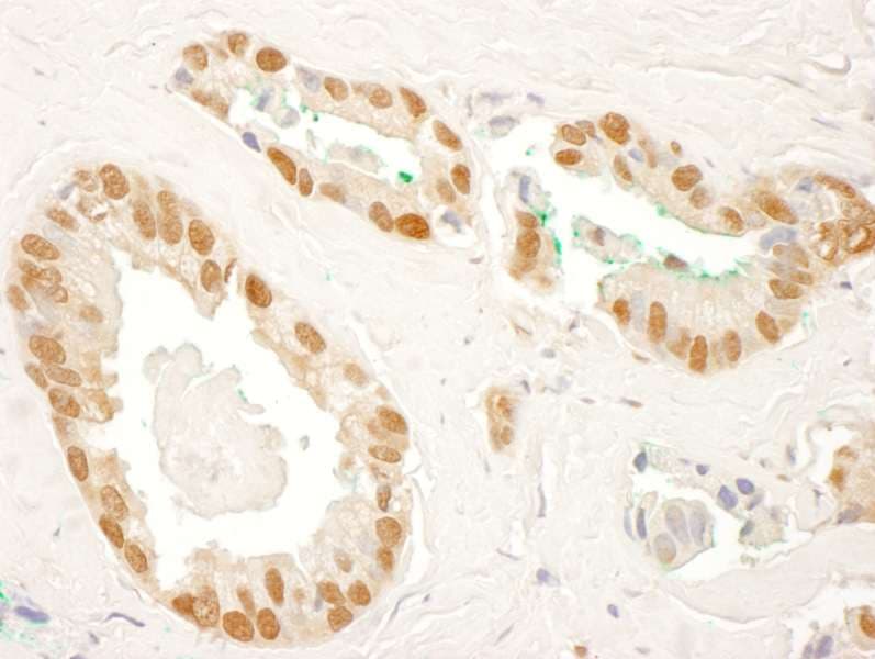 RAD23B / HR23B Antibody (aa125-175)