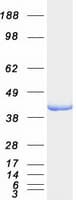 Human ALDOB Protein (Recombinant Myc-DDK (Flag))