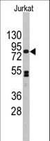 CDH12 / Cadherin 12 Antibody (aa62-90)