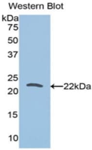 TPT1 / TCTP Antibody (aa1-172)