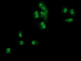 IHC-plus™ SNX8 Antibody (clone 4F8)