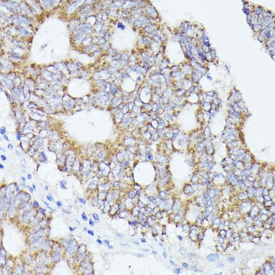 Polyclonal Rabbit anti-Human ACAT2 Antibody (IHC, IF)