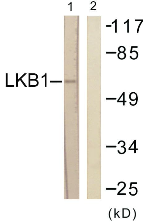 STK11 / LKB1 Antibody (p189)