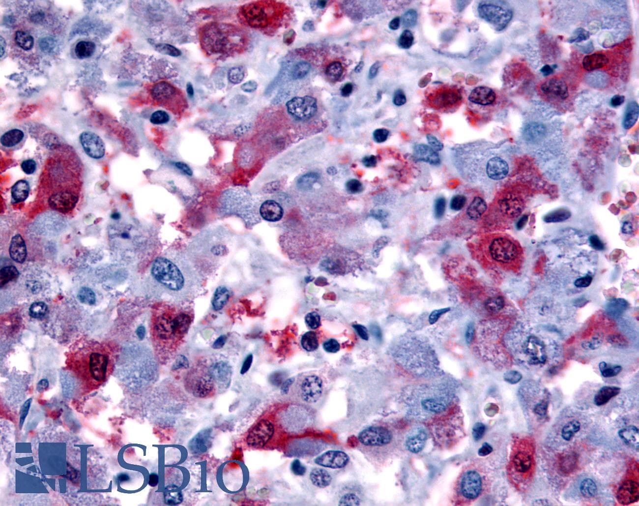 IHC-plus™ FP / PTGFR Antibody (Cytoplasmic Domain)