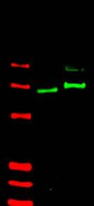 IHC-plus™ Polyclonal Rabbit anti-Human GLI2 Antibody (IHC, WB)