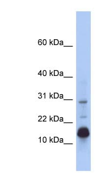 Polyclonal Rabbit anti-Human HIST2H2BF Antibody (N-Terminus, WB)