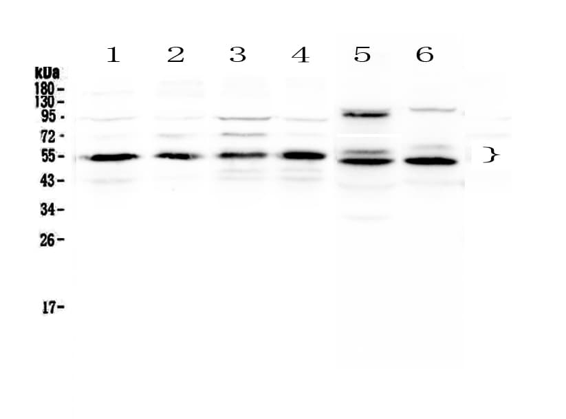 Polyclonal Rabbit anti-Human RXTA / RXR-Alpha Antibody (IHC, WB)