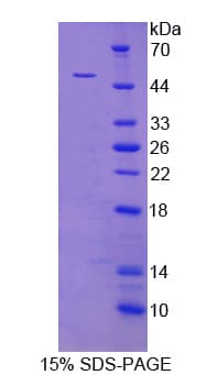 Human IDH2 Protein (Recombinant His)