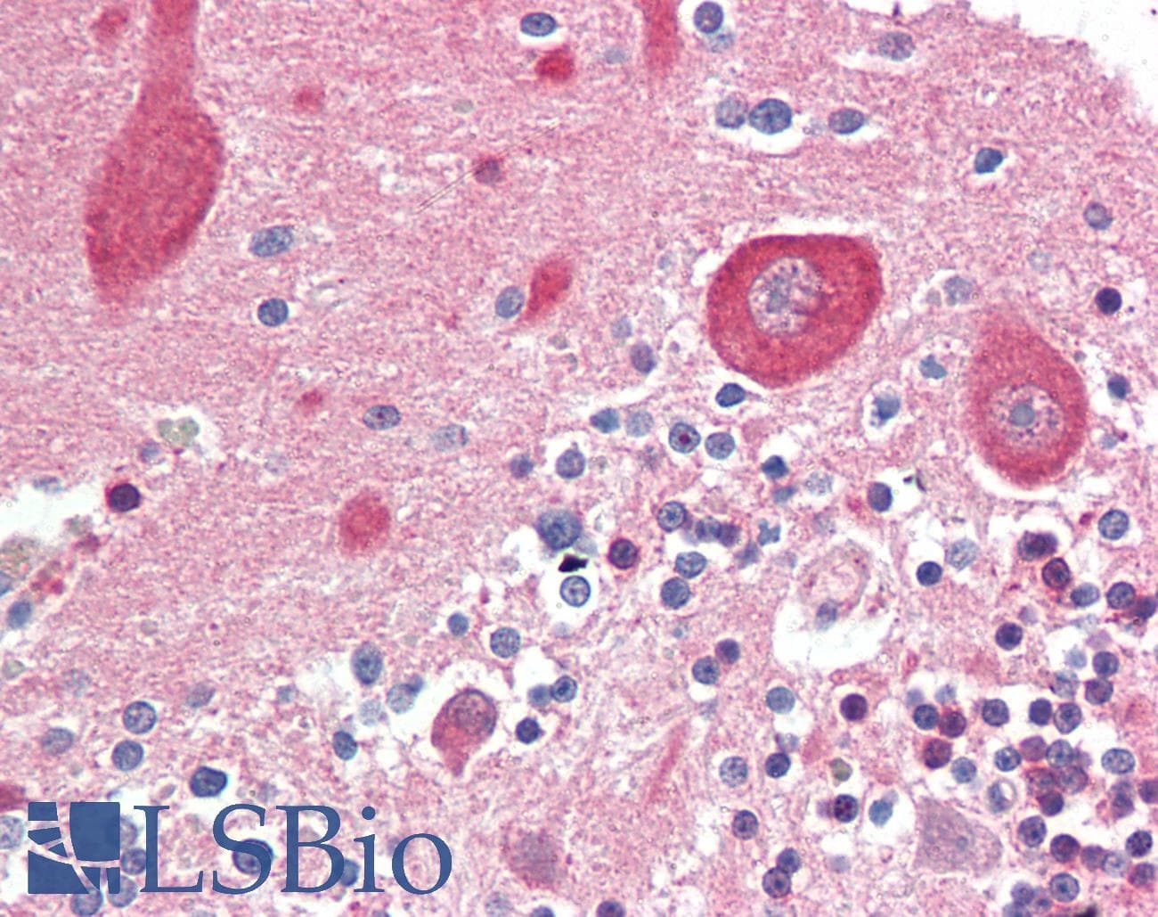 IHC-plus™ MAP2K1 / MKK1 / MEK1 Antibody (N-Terminus)