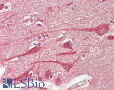IHC-plus™ TM2D1 / BBP Antibody (Internal)