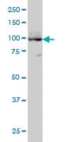 IHC-plus™ ATP2A3 / SERCA3 Antibody (clone 2H3)