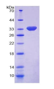 Human EBF / EBF1 Protein (Recombinant His-T7)