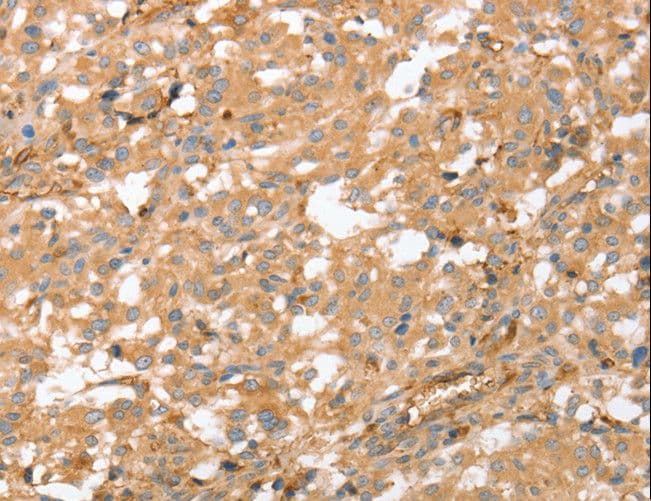 Polyclonal Rabbit anti-Human AHSG / Fetuin A Antibody (IHC, WB)