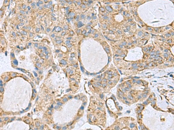 Polyclonal Rabbit anti-Human CLTB Antibody (IHC, WB)