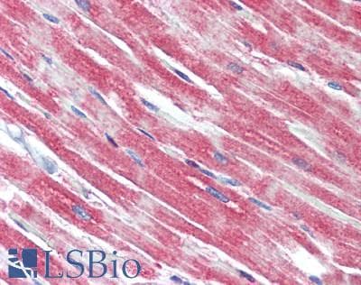 IHC-plus™ Polyclonal Rabbit anti-Human LRRN3 Antibody (IHC, WB)