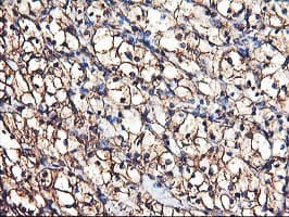 TUBAL3 Antibody (aa150-446, clone OTI2F6, Carrier-free)
