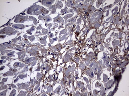 Monoclonal Mouse anti-Human NUMB Antibody (clone OTI3H8, aa1-365, IHC, WB)