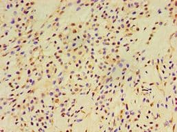 Polyclonal Rabbit anti-Human EXOC2 / SEC5 Antibody (aa1-220, IHC)
