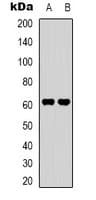 Polyclonal Rabbit anti-Human SVOP Antibody (Internal, IHC, WB)