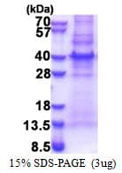 Human CENPU / MLF1IP Protein (Recombinant His)