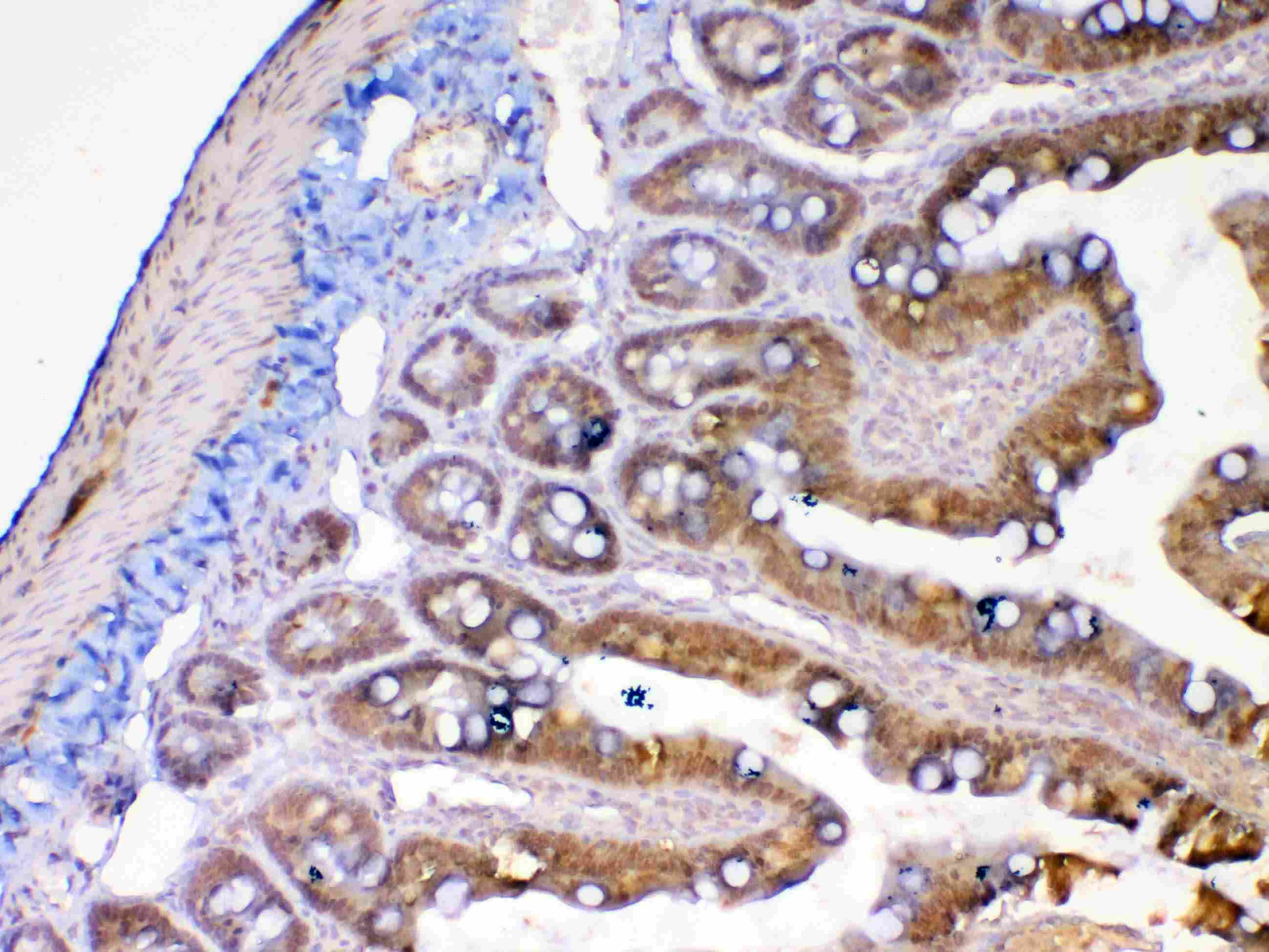 MMP13 Antibody