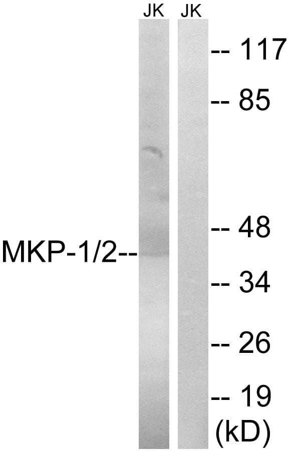 MKP1 + MKP2 Antibody (p296/318)