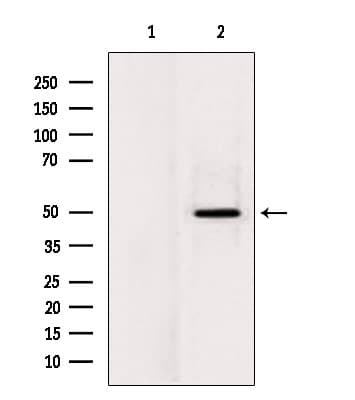 LPCAT2 Antibody