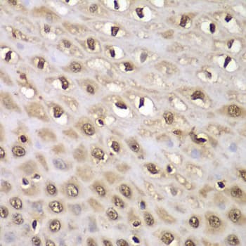Polyclonal Rabbit anti-Human INTS5 Antibody (IHC, WB)