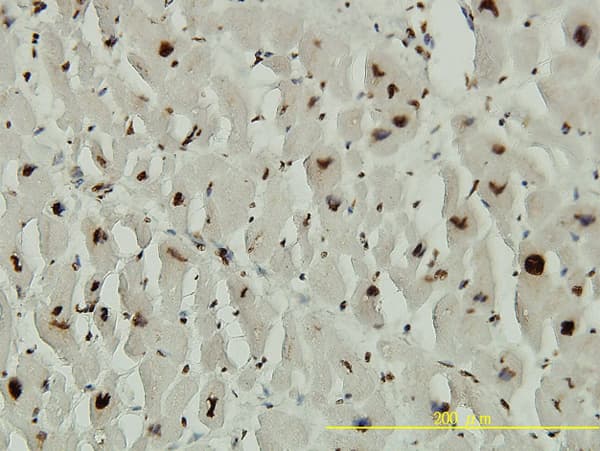 Monoclonal Mouse anti-Human ACD / PTOP Antibody (clone 1D8-1B6, IHC, IF, WB)