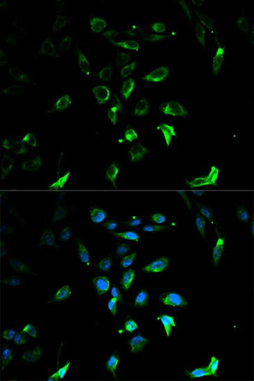 Polyclonal Rabbit anti-Human STAR Antibody (IF, WB)