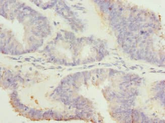 RGS7 Antibody