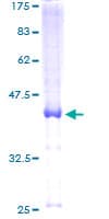 Human LRRC8D / LRRC5 Protein (Recombinant GST)