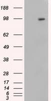 APP / Beta Amyloid Precursor Antibody (clone OTI6B7)