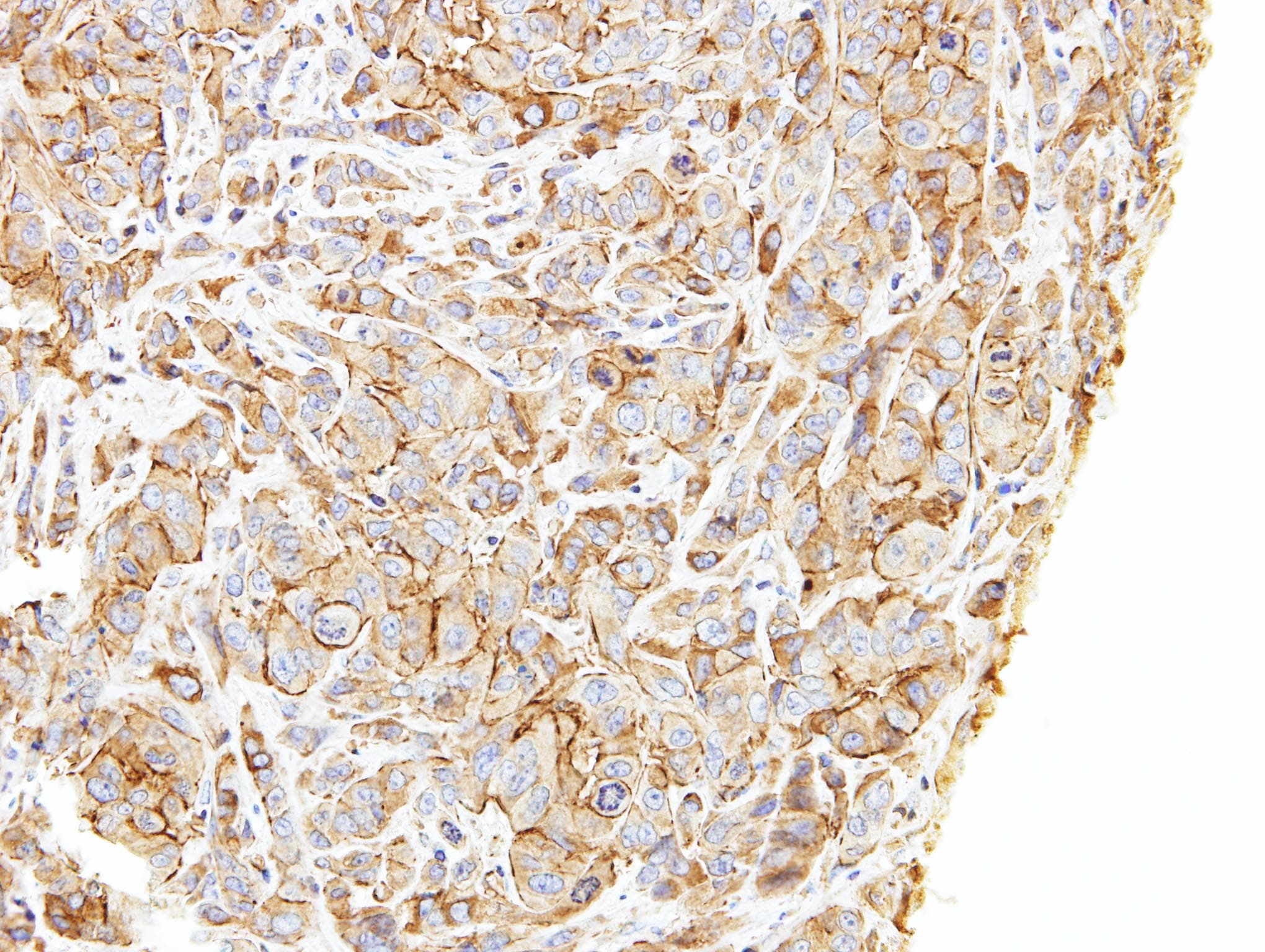 LIMCH1 Antibody (aa734-1007)