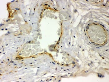 F2R / Thrombin Receptor / PAR1 Antibody