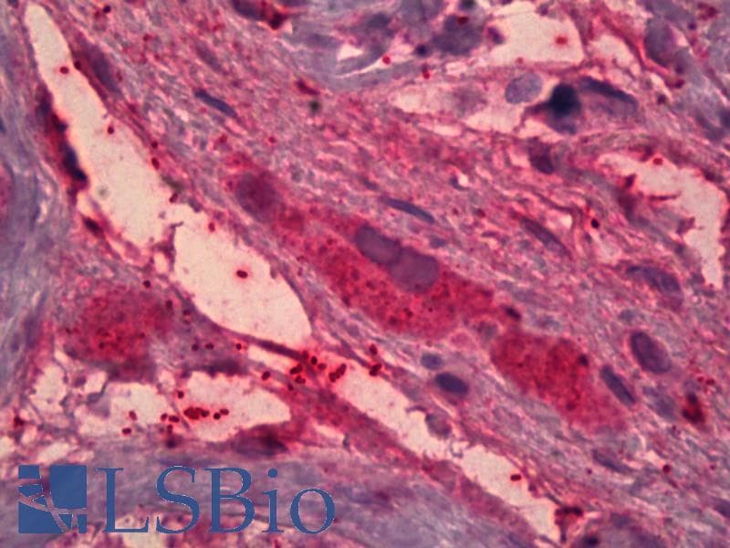IHC-plus™ ITIH4 Antibody (aa890-903)