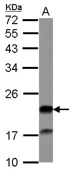 GCL / Grancalcin Antibody