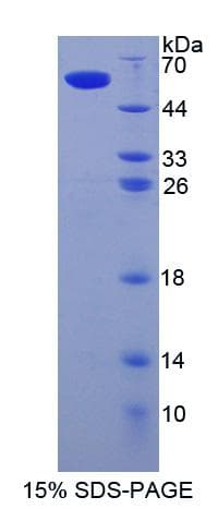 Human SIGLEC8 Protein (Recombinant His-GST-S)