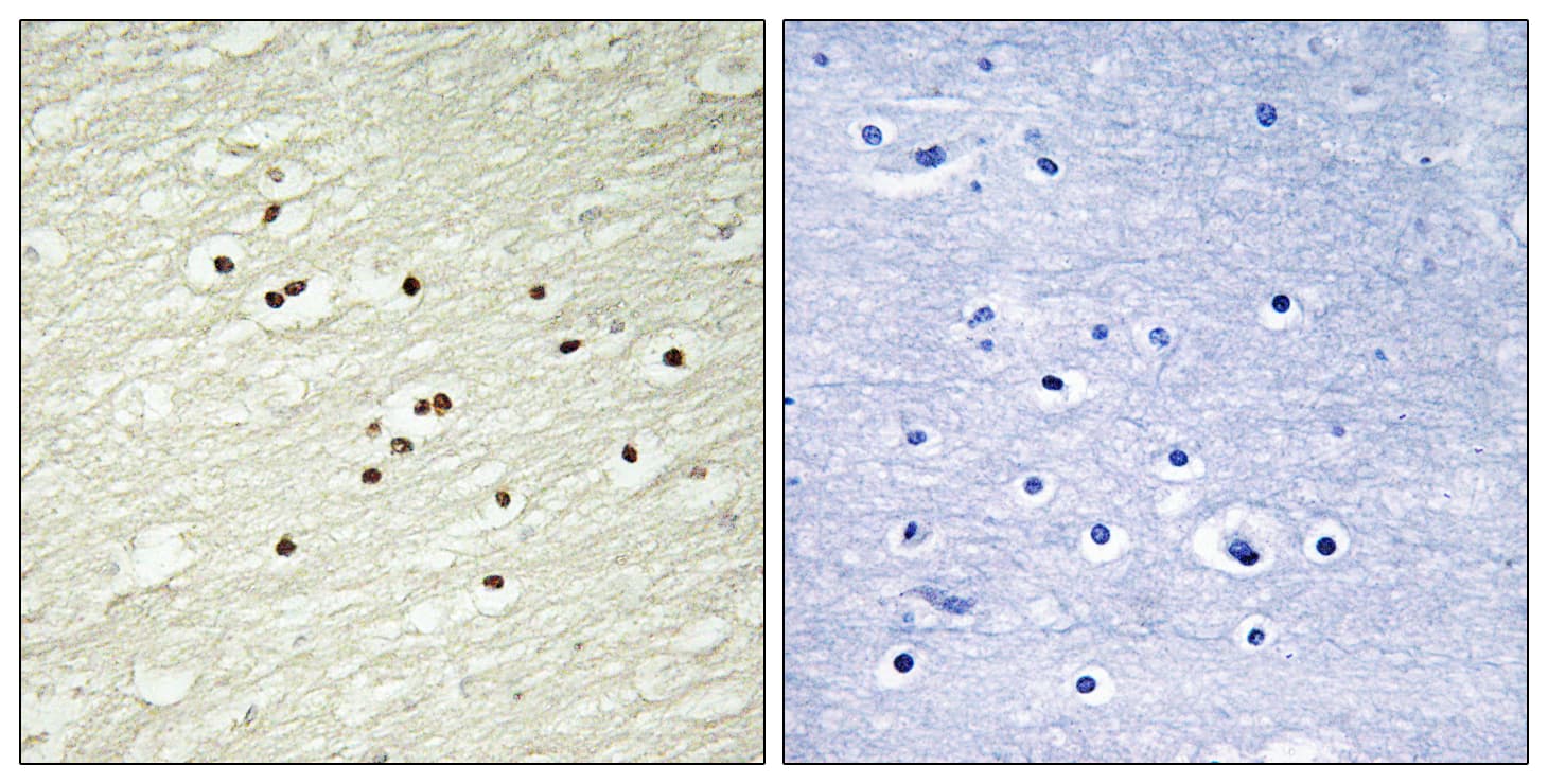 Polyclonal Rabbit anti-Human CCNH / Cyclin H Antibody (aa274-323, IHC, IF, WB)