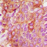 Polyclonal Rabbit anti-Human BAX Antibody (Internal, IHC, IF, WB)