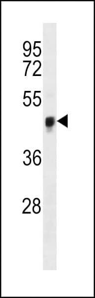 YAP / YAP1 Antibody (aa104-133)