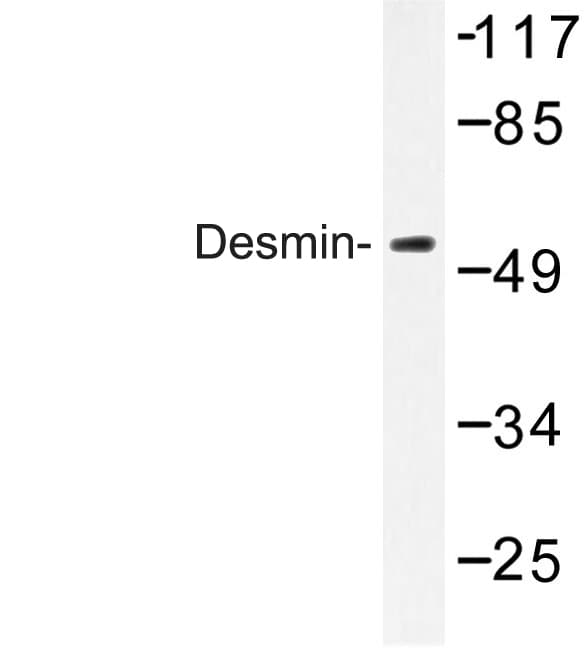 DES / Desmin Antibody (Val56)
