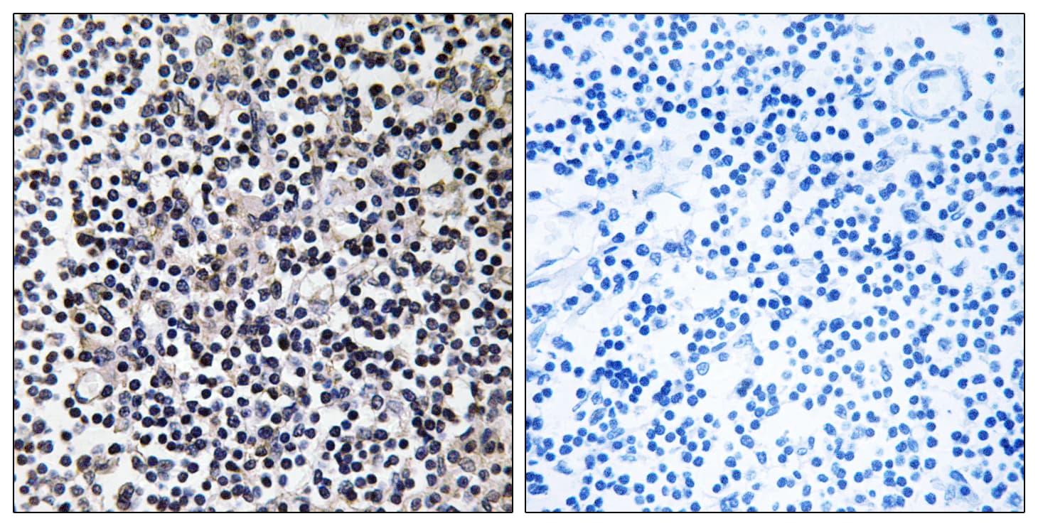 ERIC-1 / TACC3 Antibody (aa789-838)